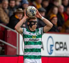 A few players with niggles” – Celtic Injury Update Ahead of Falkirk Tie